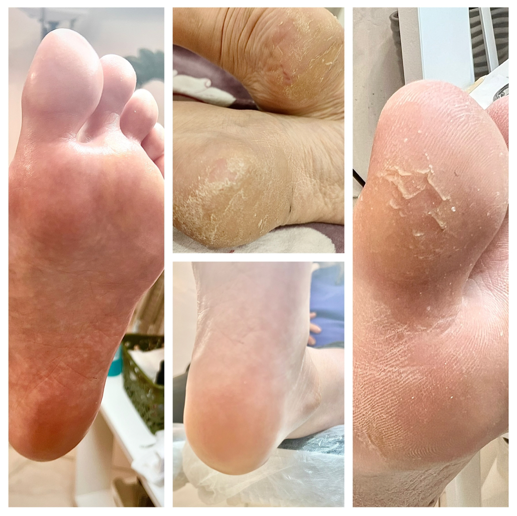 Педикюр SMART Обработка стопы + пальчики + покрытие