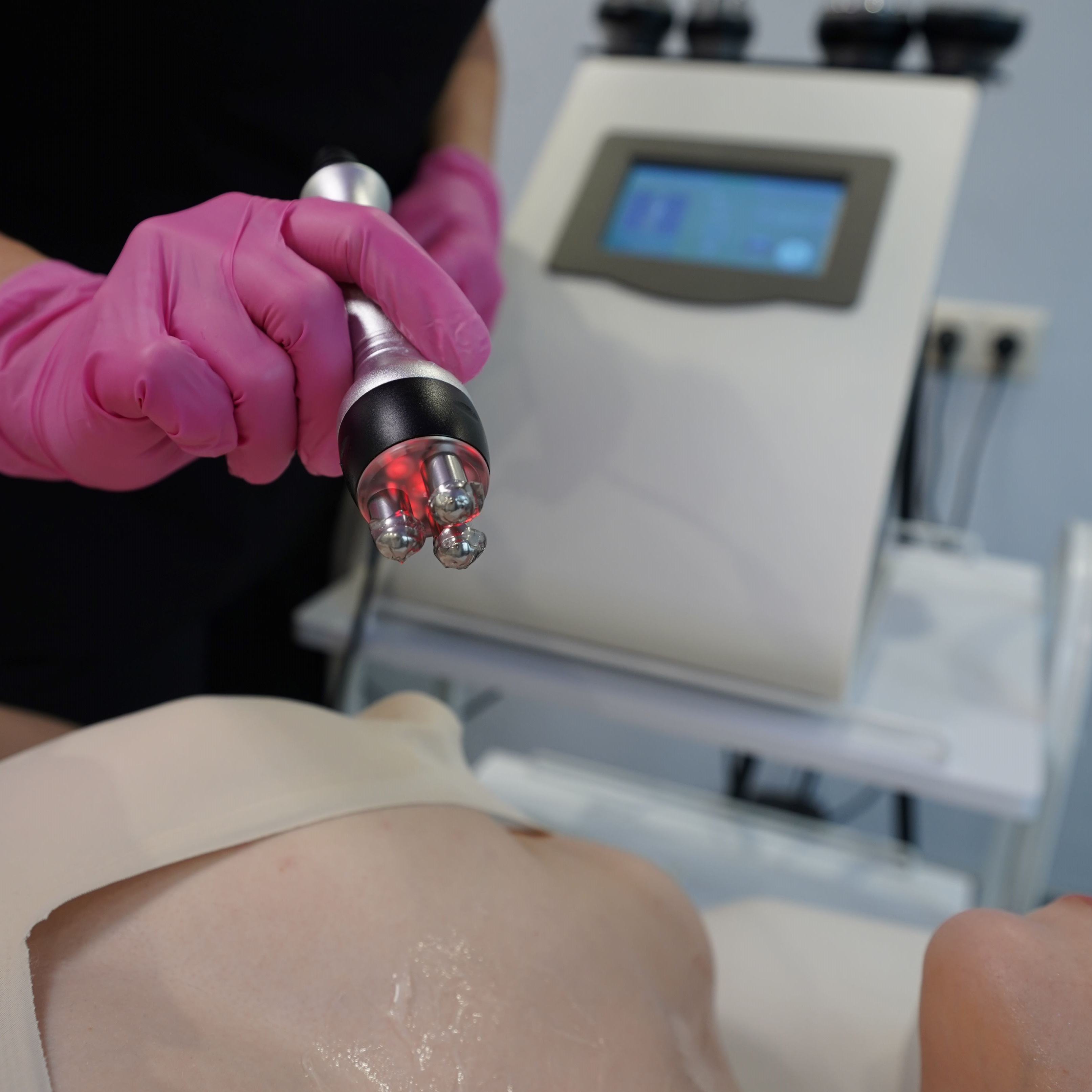 RF-лифтинг (на зону тела)