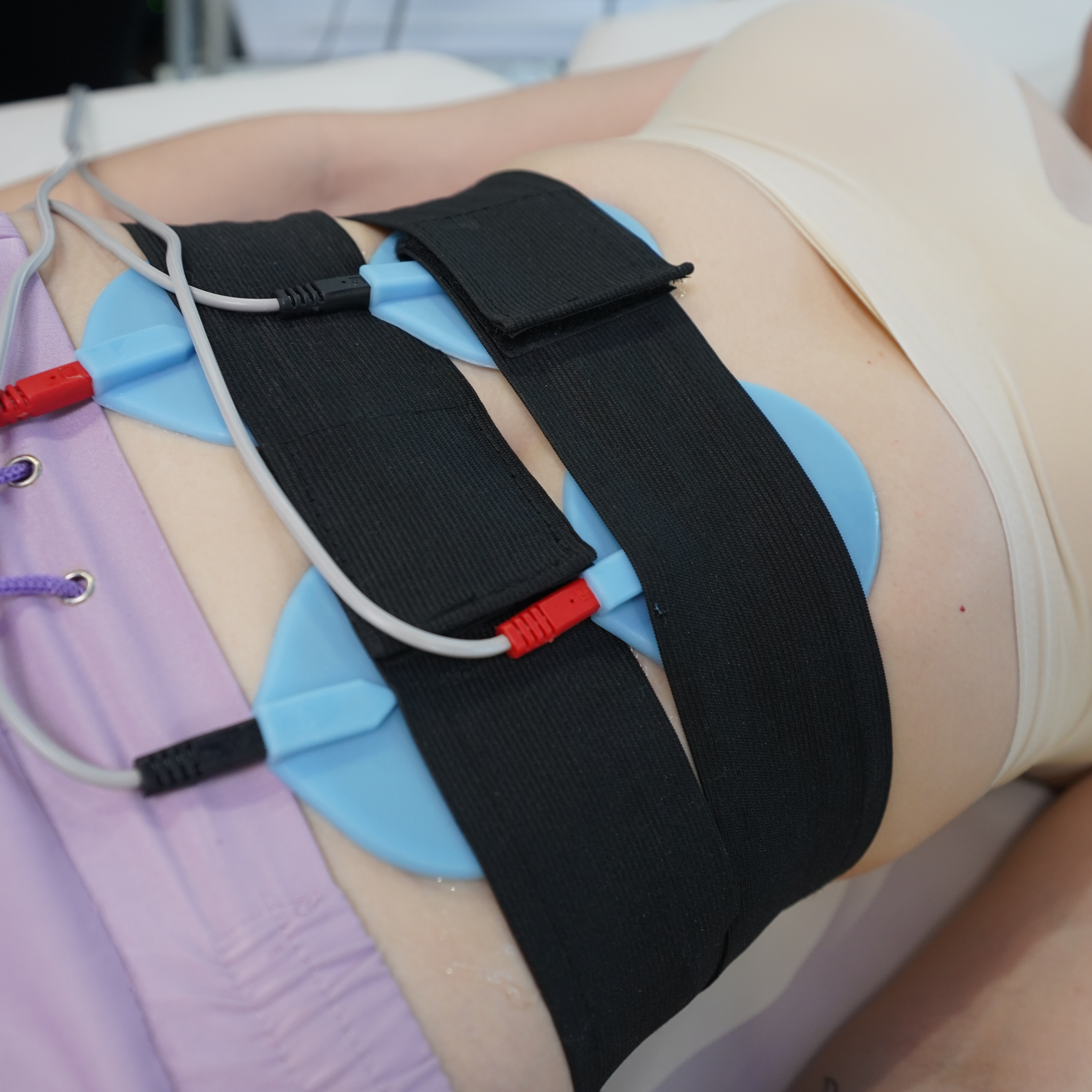 Миостимуляция (зона)