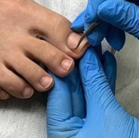 Стабилизирующая система