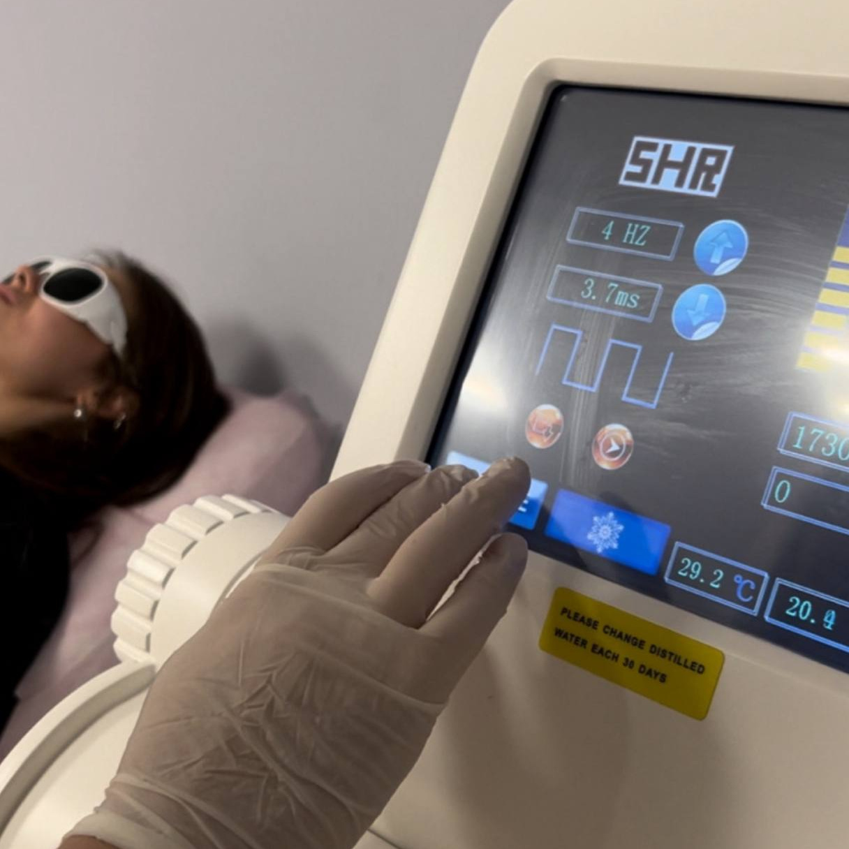 Лазерная эпиляция LITE