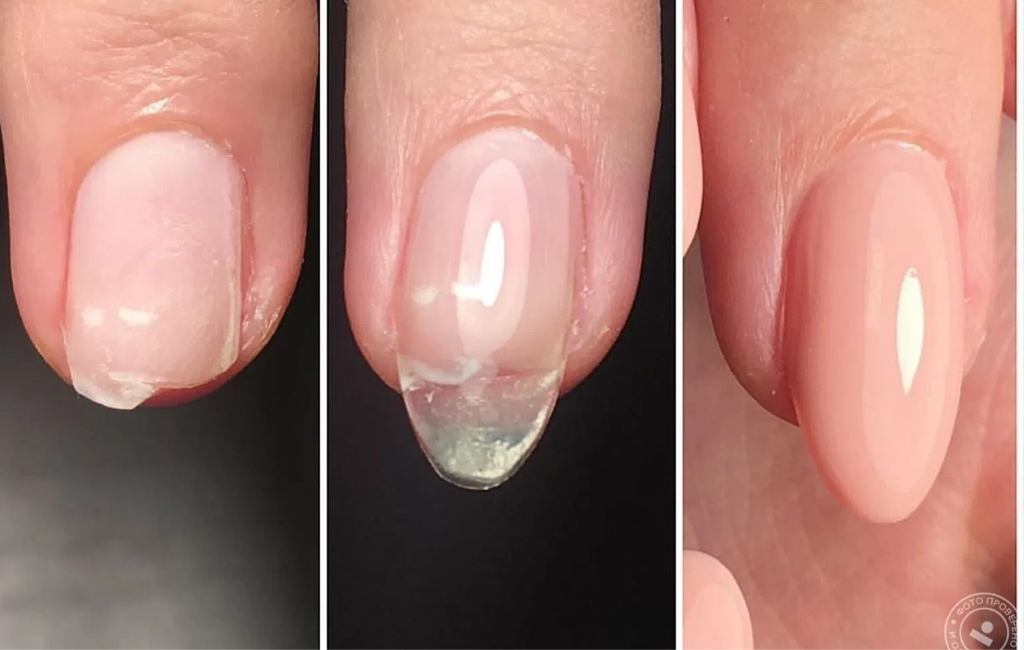 Ремонт нарощенного ногтя