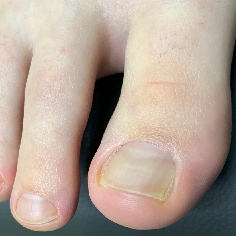 Педикюр без покрытия только пальчики