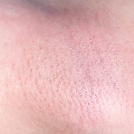 Подмышечные впадины.