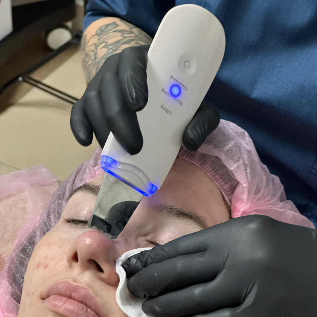 Чистка лица