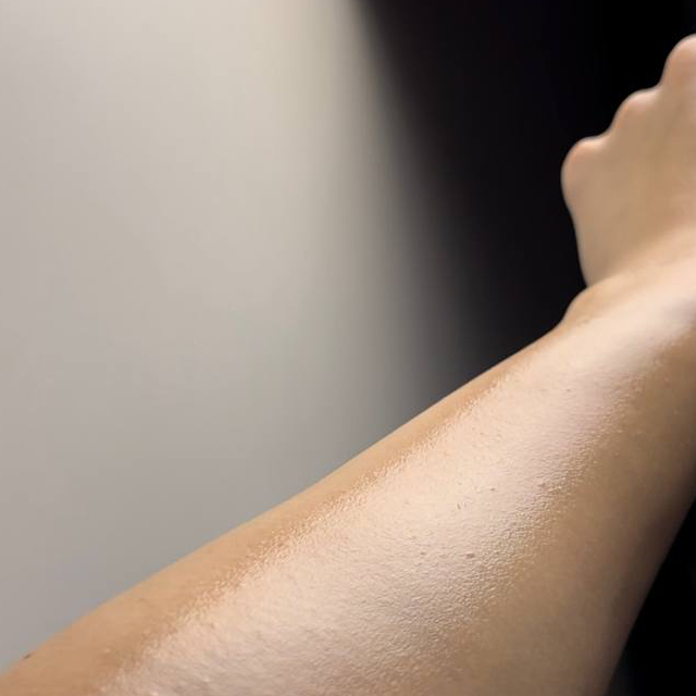 Лазер руки до локтя