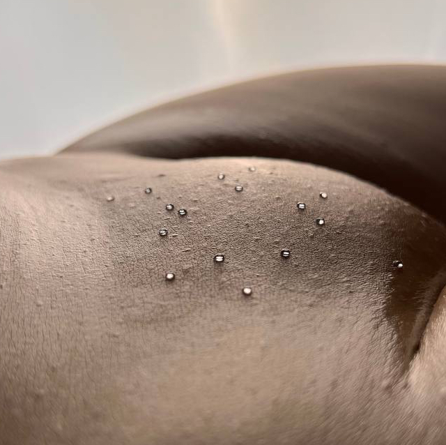 Лазер глубокое бикини