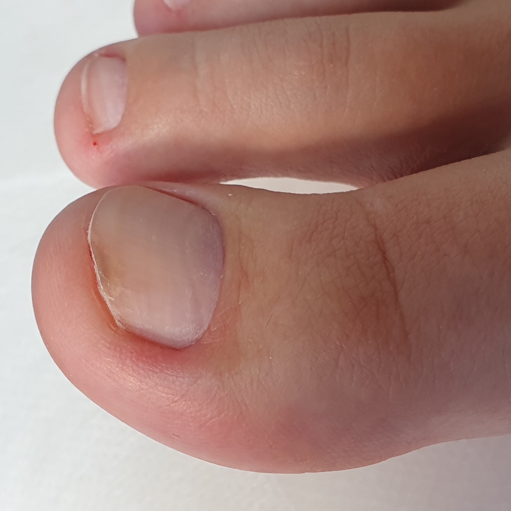 снятие покрытия+обработка пальчиков