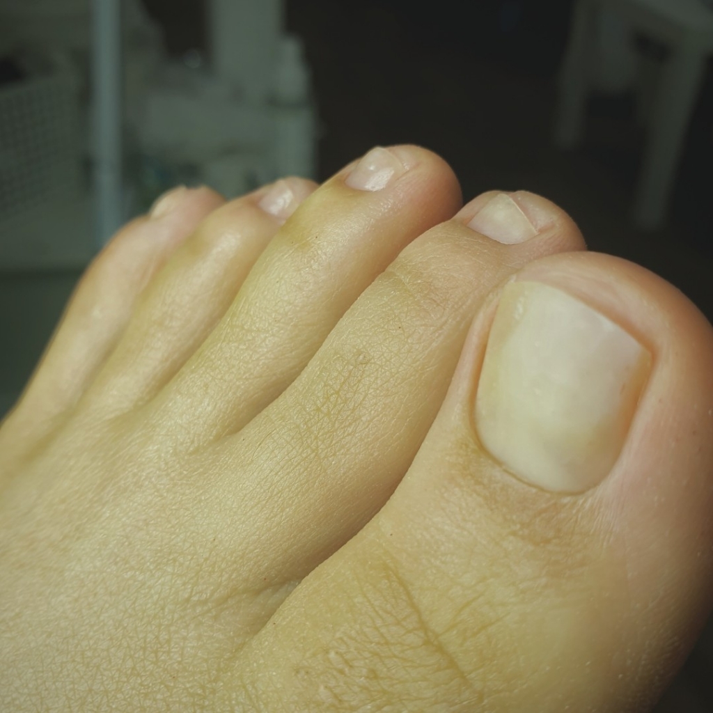 Педикюр пальцы