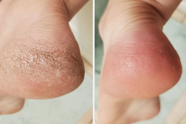 Smart педикюр полный без покрытия