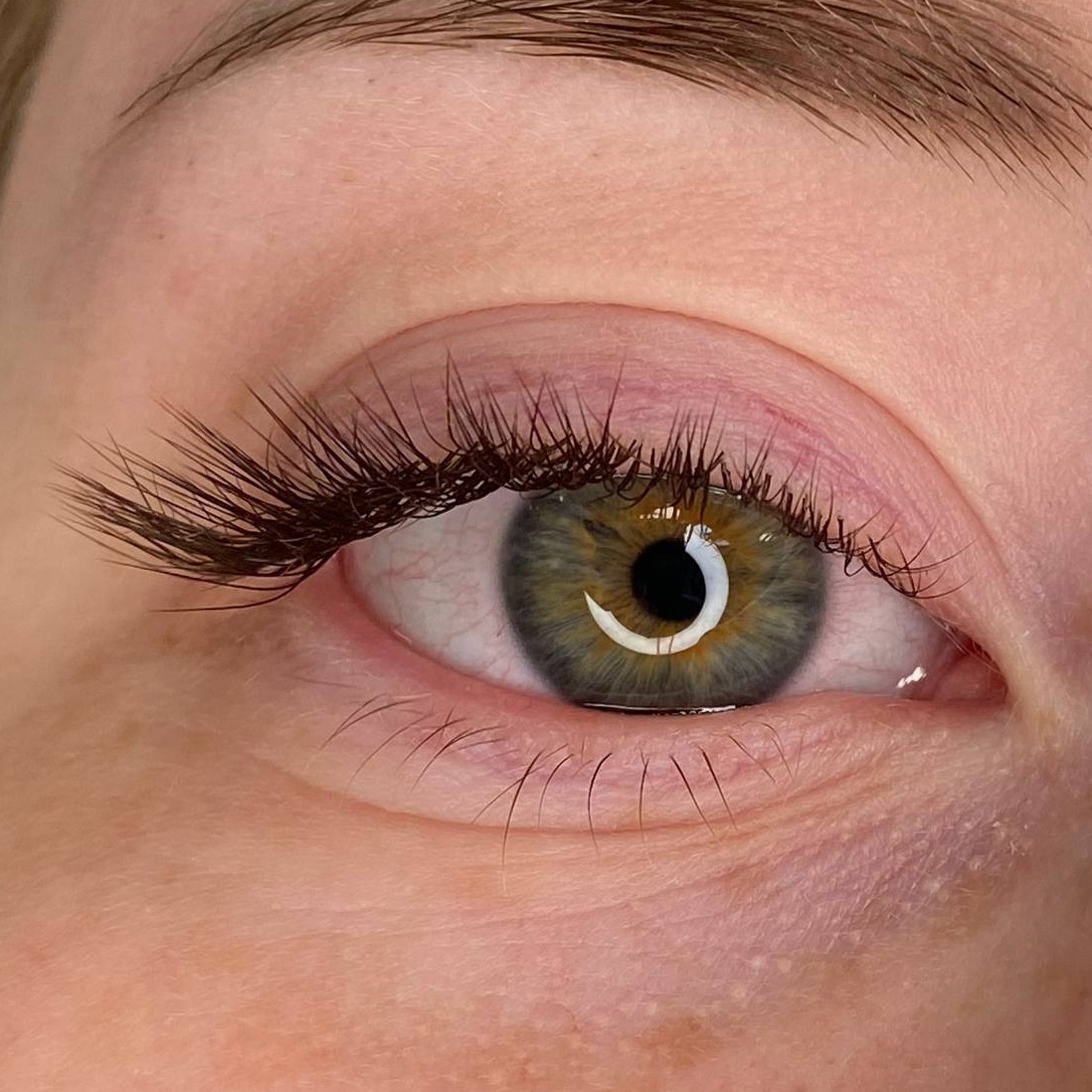 1D - классическое наращивание