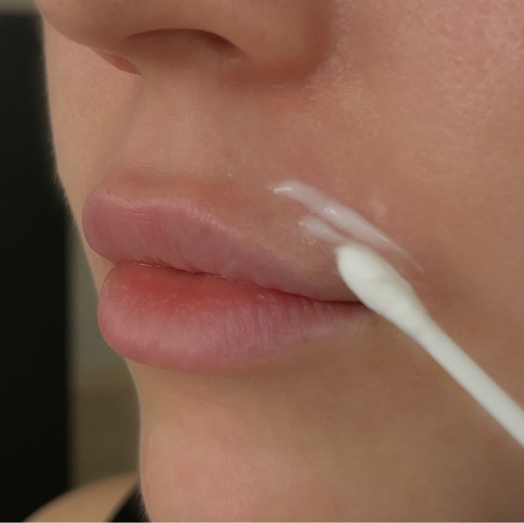 Удаление пушка над губой