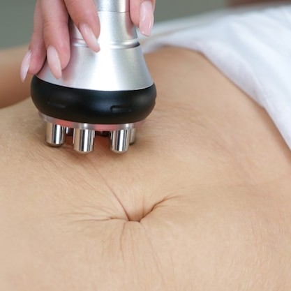 RF -лифтинг живота