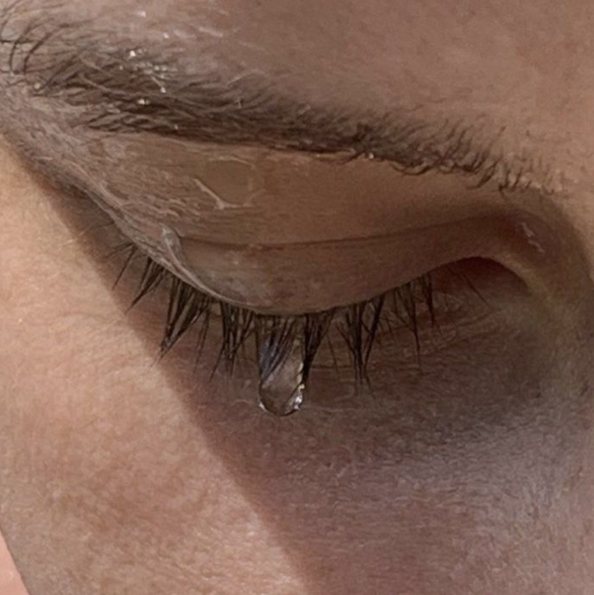 снятие наращивания