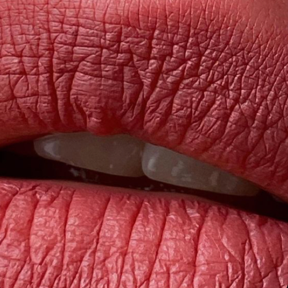 удаление пуха над губой