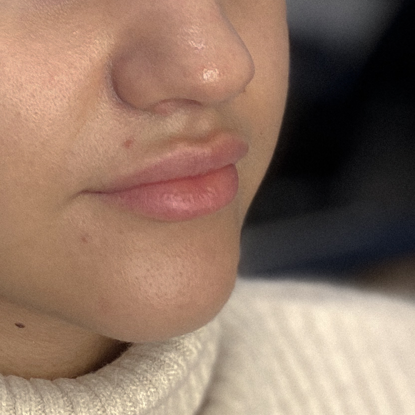 Восковая депиляция над губой/в носовых пазухах