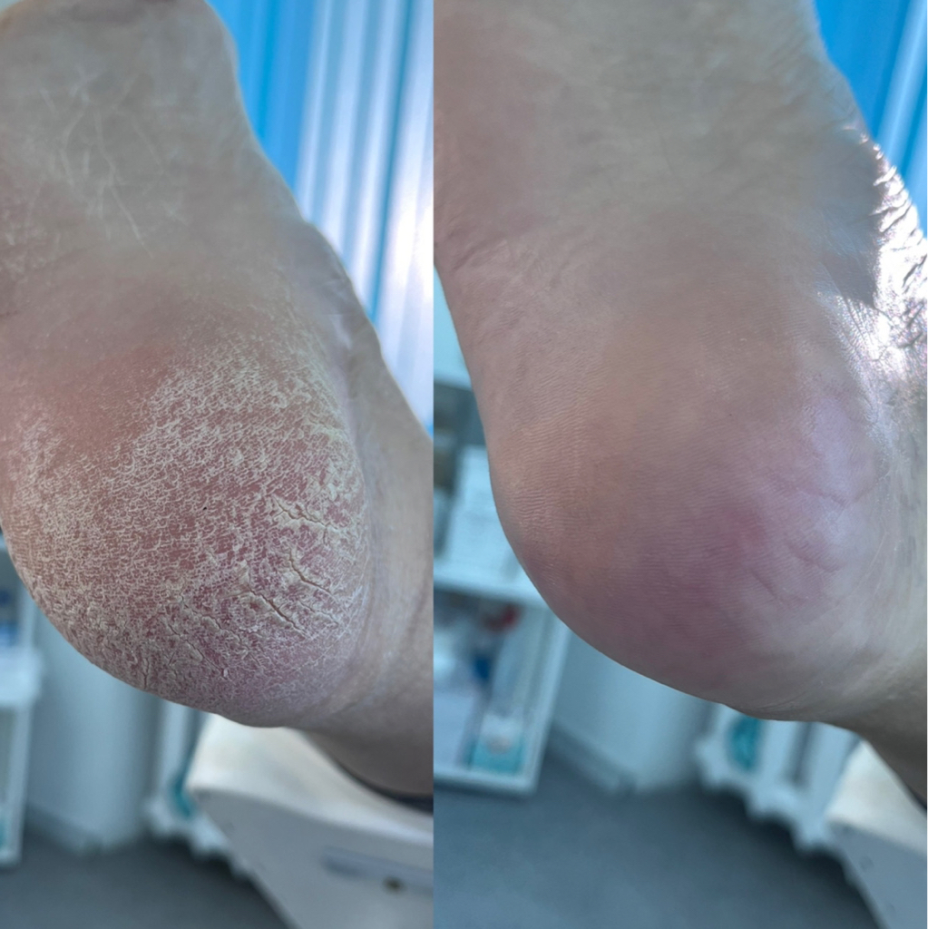 Полный смарт педикюр , без покрытия