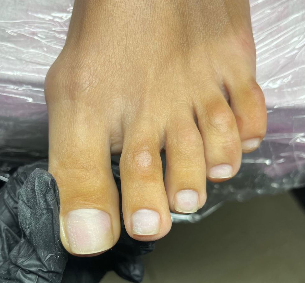 Комплекс “light”