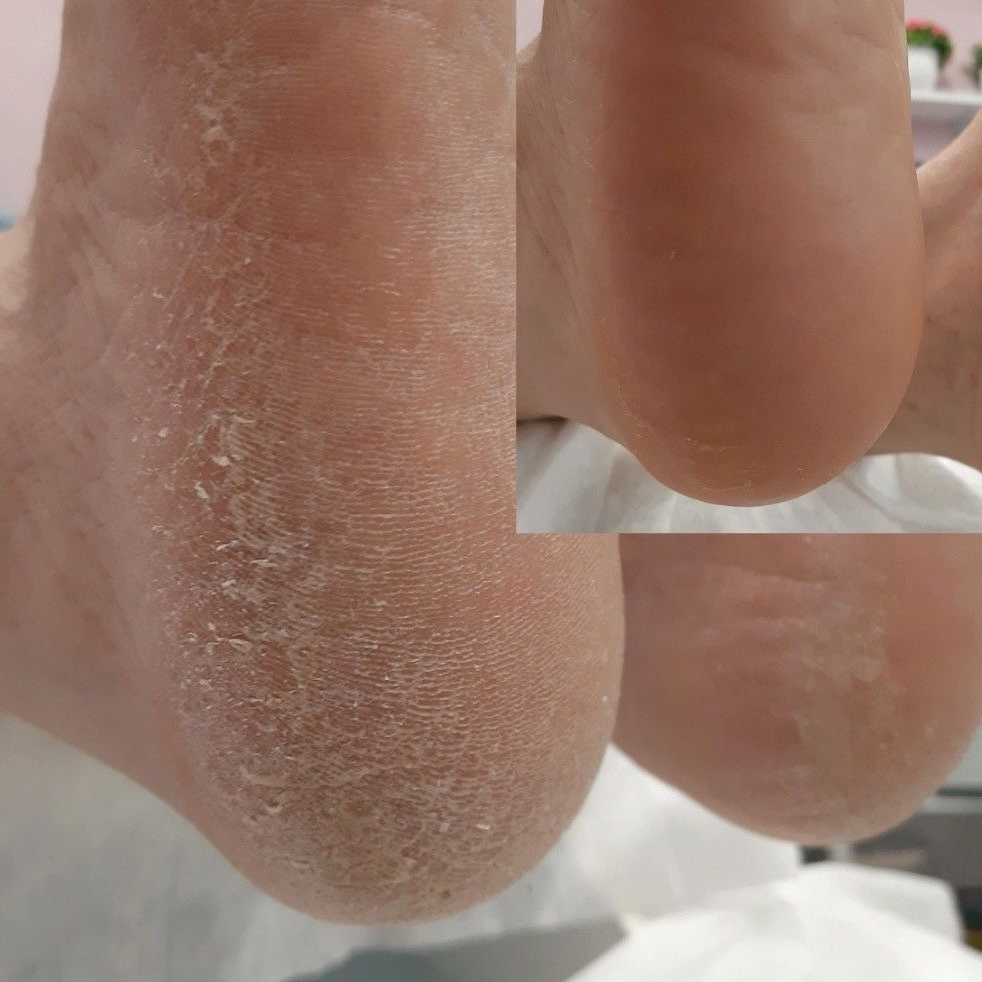 Педикюр аппаратный SMART