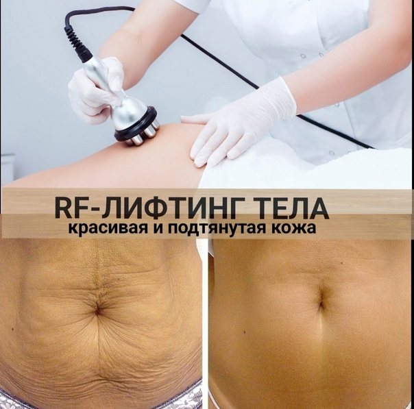 РФ лифтинг тела