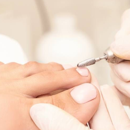 Снятие ног ( пальчики) без обработки