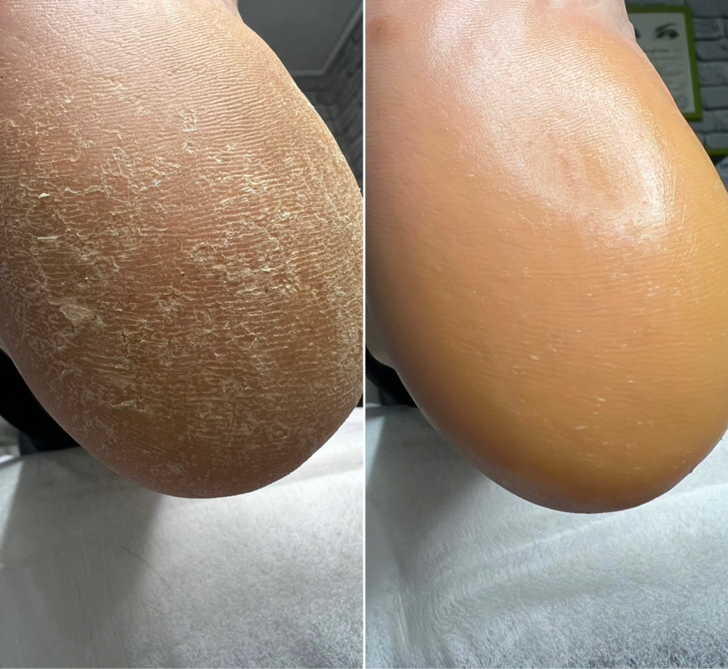 SMART- педикюр (без покрытия)