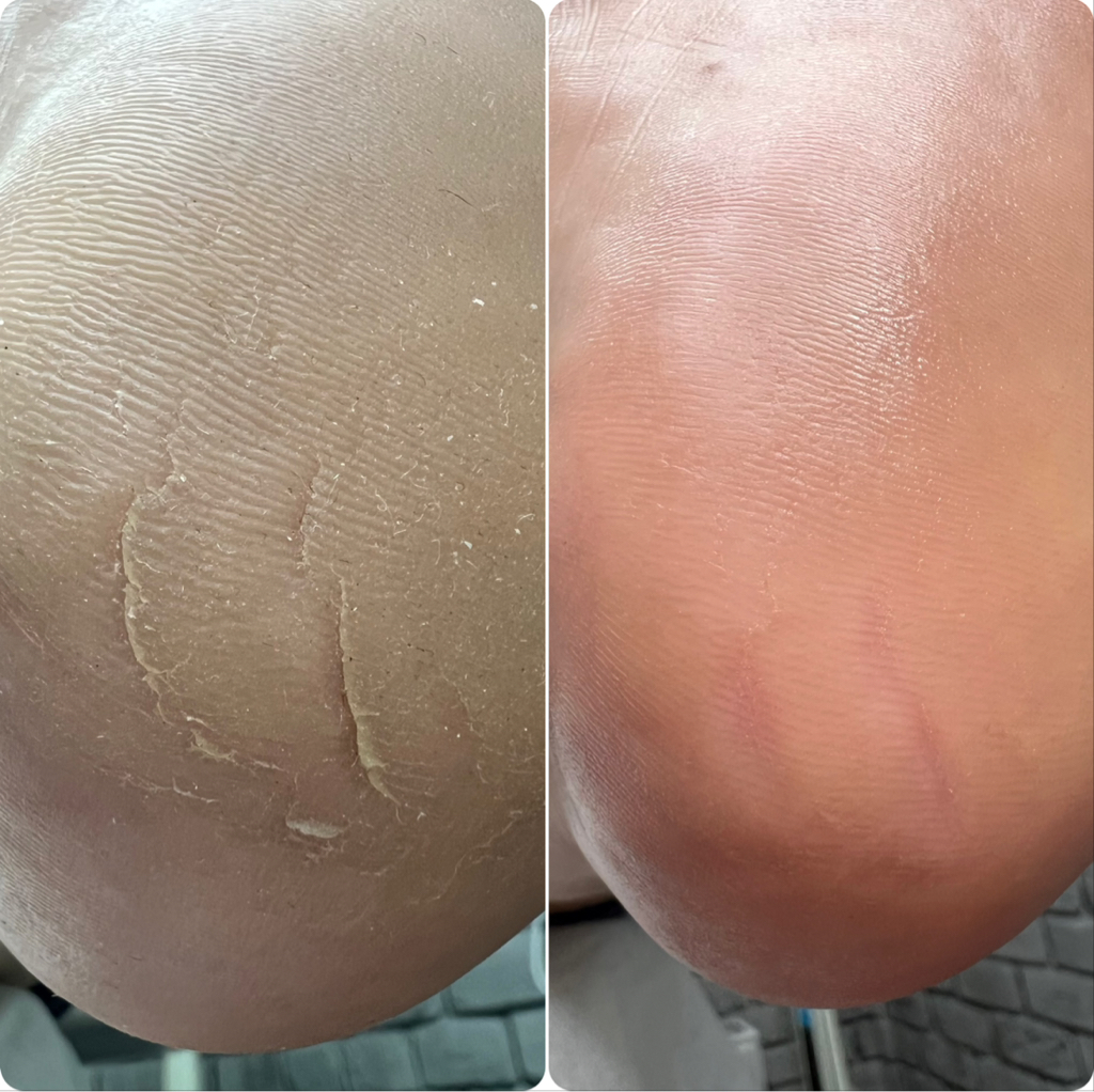 SMART-педикюр (с покрытием)