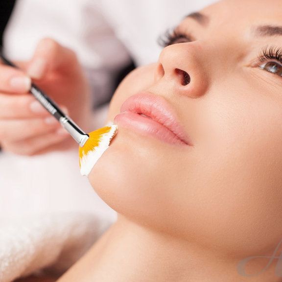 Молочный пилинг