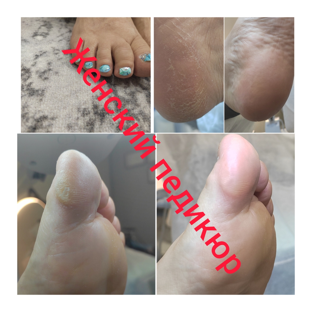 SMART педикюр! Мужской и женский
