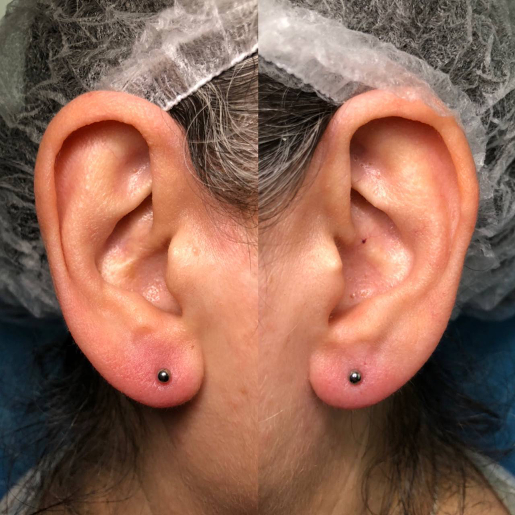 Мочки + украшения