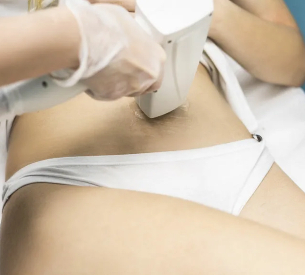 Полосочка на животе