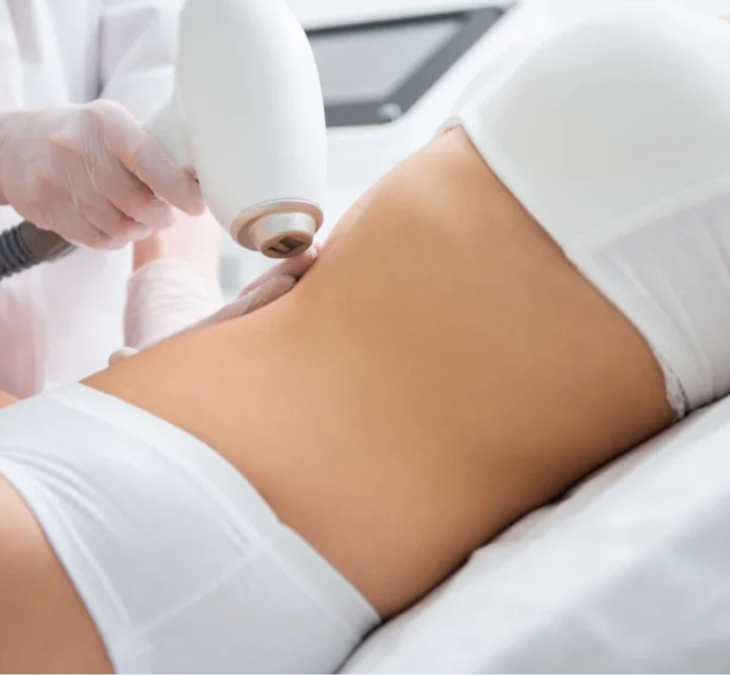 Живот  полностью ( абонемент 4 процедуры)