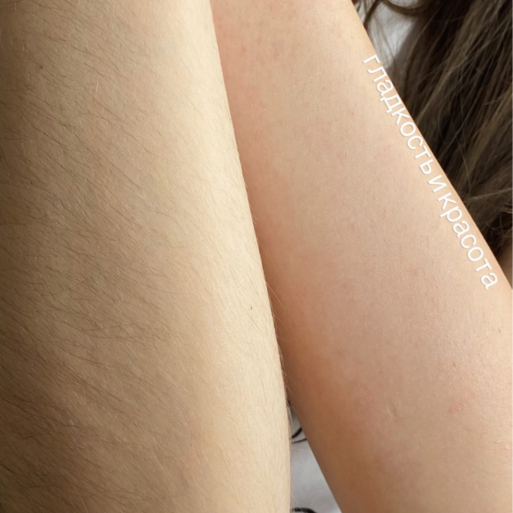 Комплекс: Бикини глубокое + ноги полностью + подмышечные впадины + руки