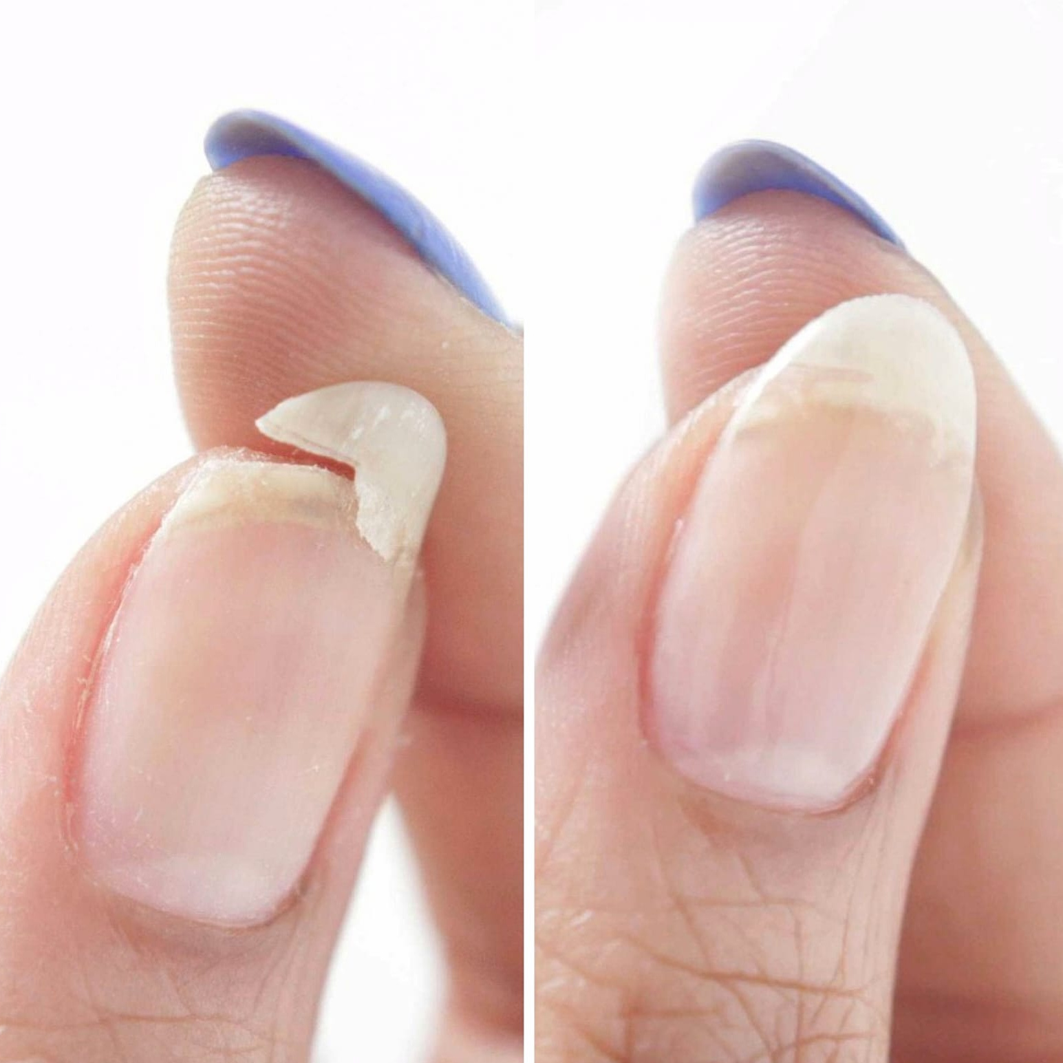 Ремонт ногтя