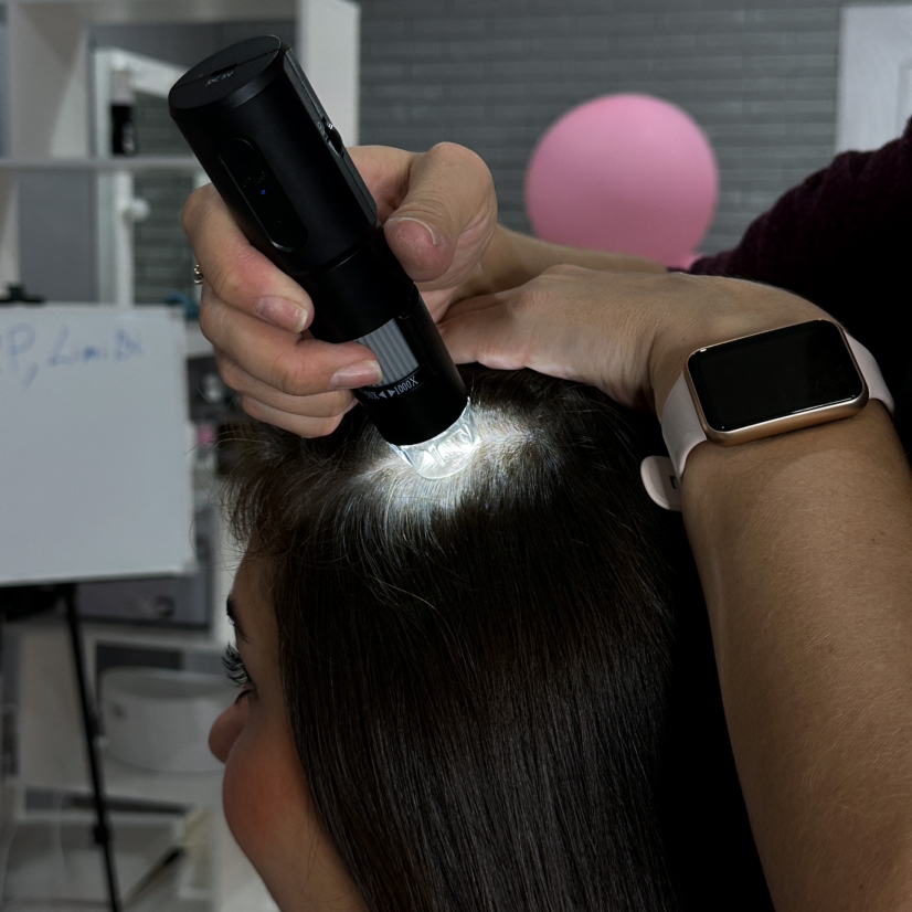 Пилинг кожи головы