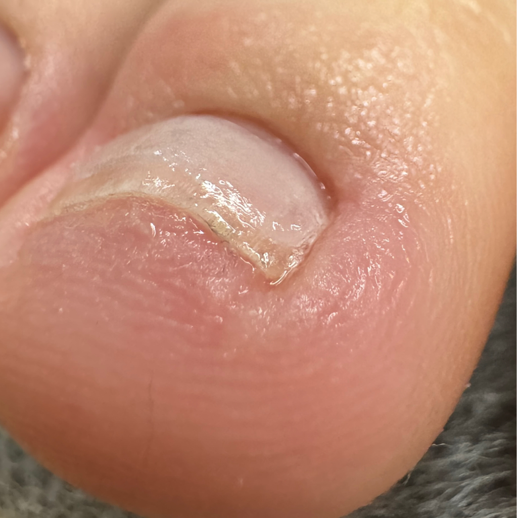 Установка КС Light System