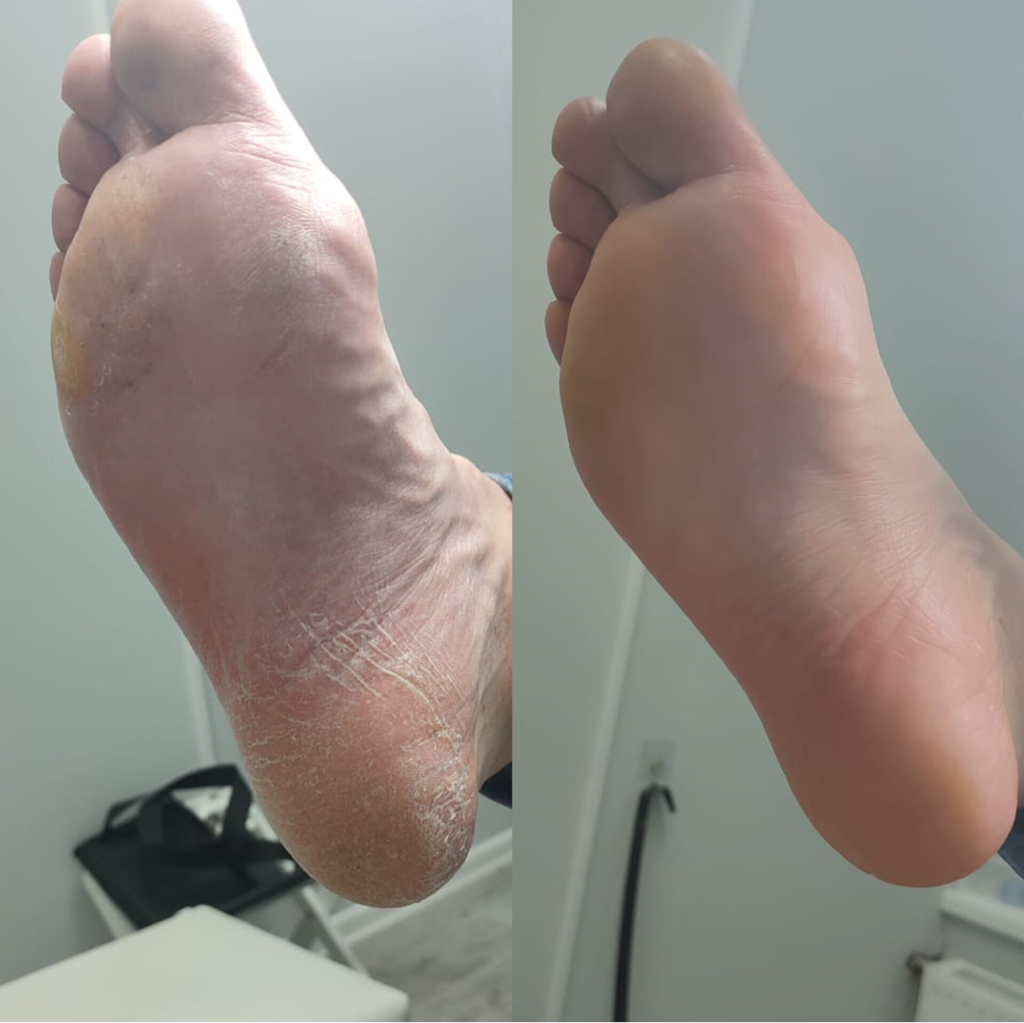 Обработка только стоп