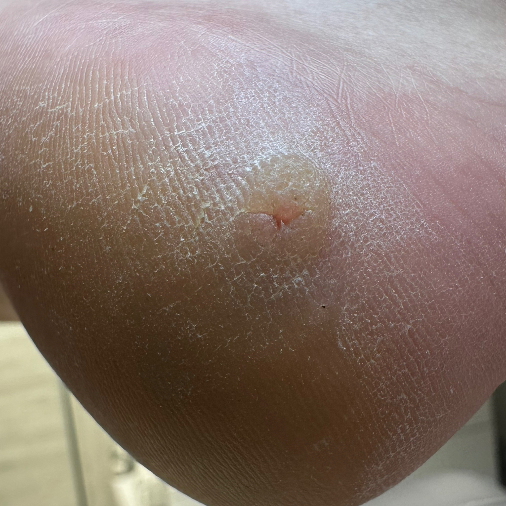 Точечное нанесение косметического средства