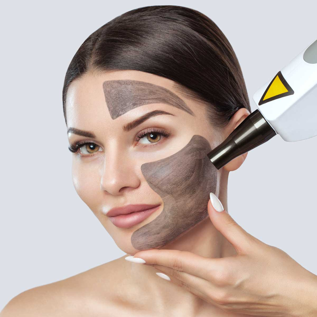 Карбоновый пиллинг + профессиональный уход по типу кожи