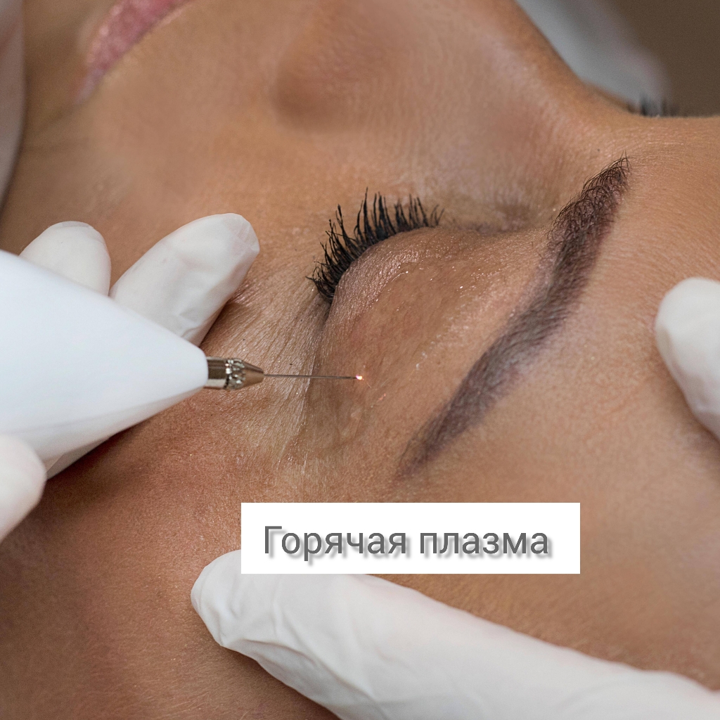 Горячая плазма