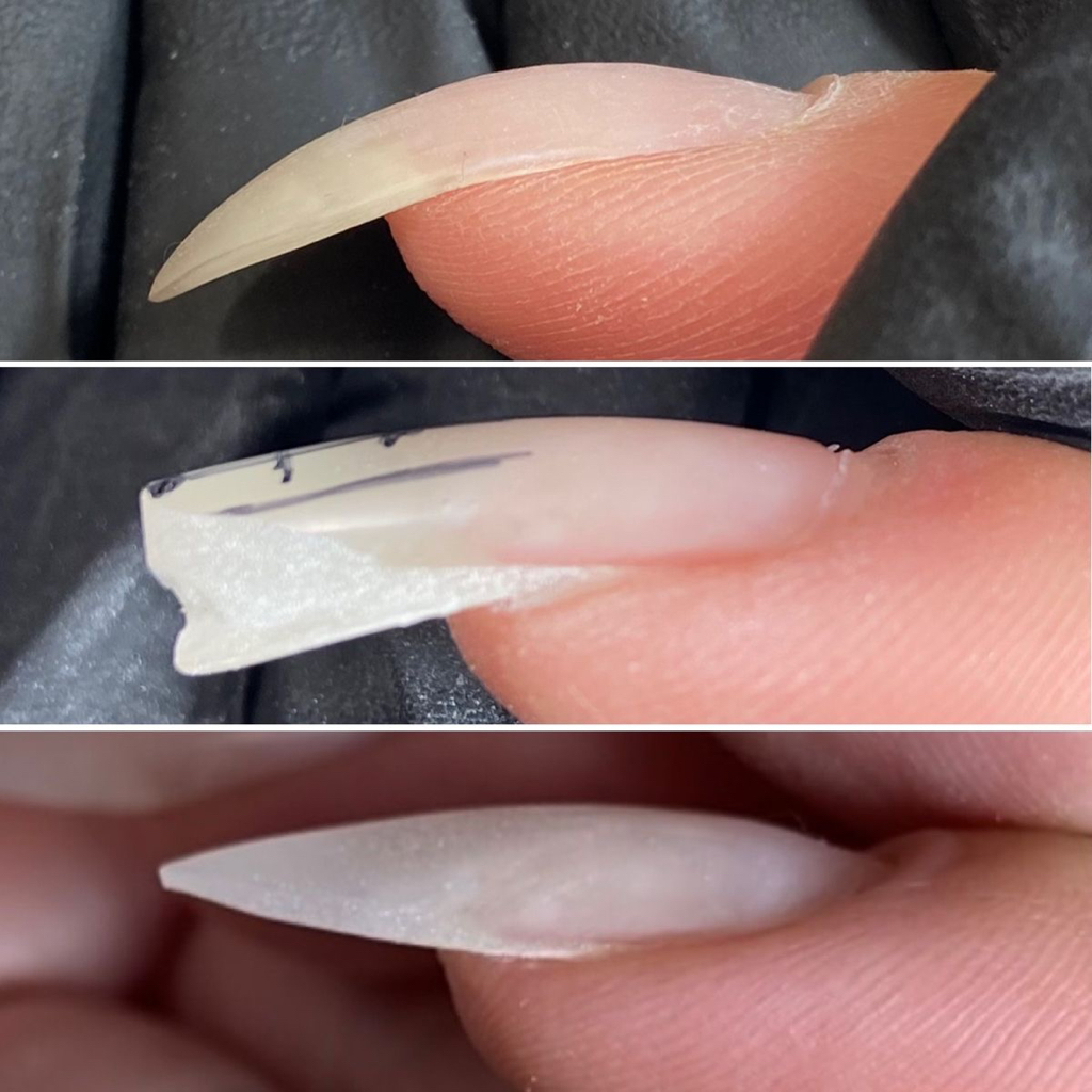 Поднятие клюющего ногтя