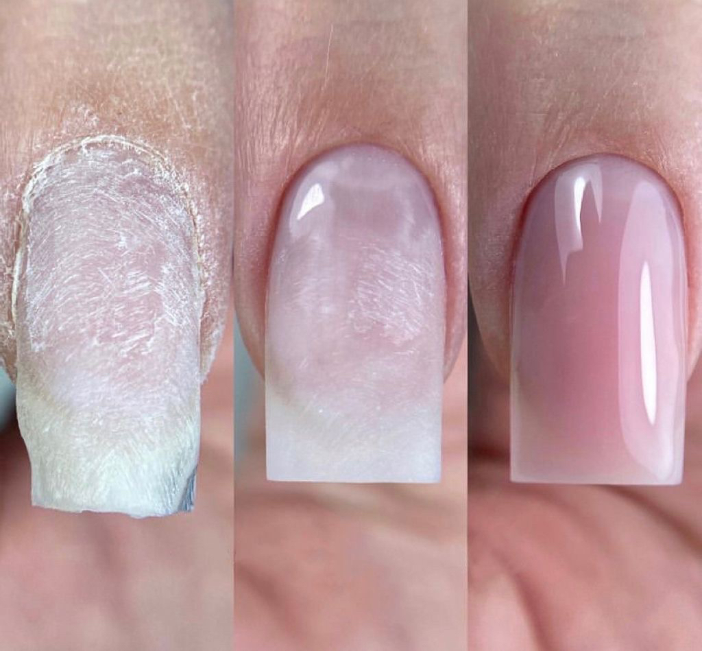 Восстановление архитектуры, углов/скручивающихся ногтей (ВСЕ НОГТИ) + УКРЕПЛЕНИЕ ГЕЛЕМ