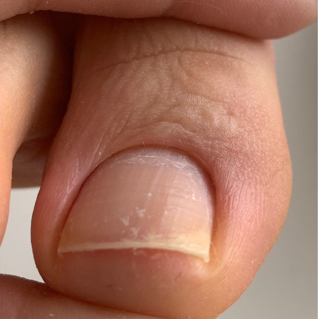 Педикюр Гигиена(пальчики)