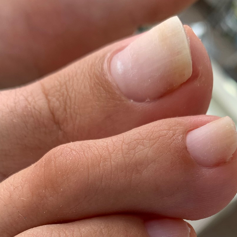 Педикюр гигиенический (стопы+пальчики без покрытия)