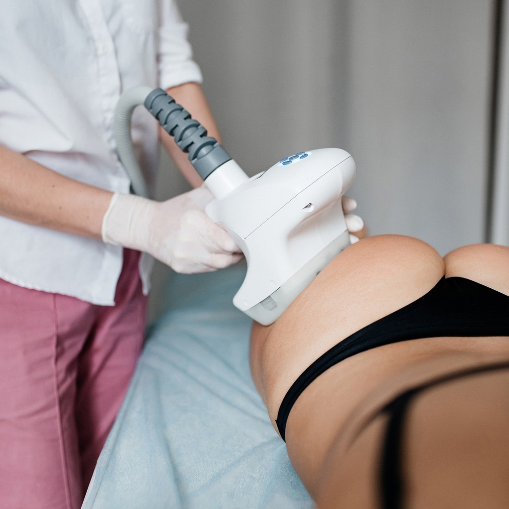 VelaShape (живот, бока)