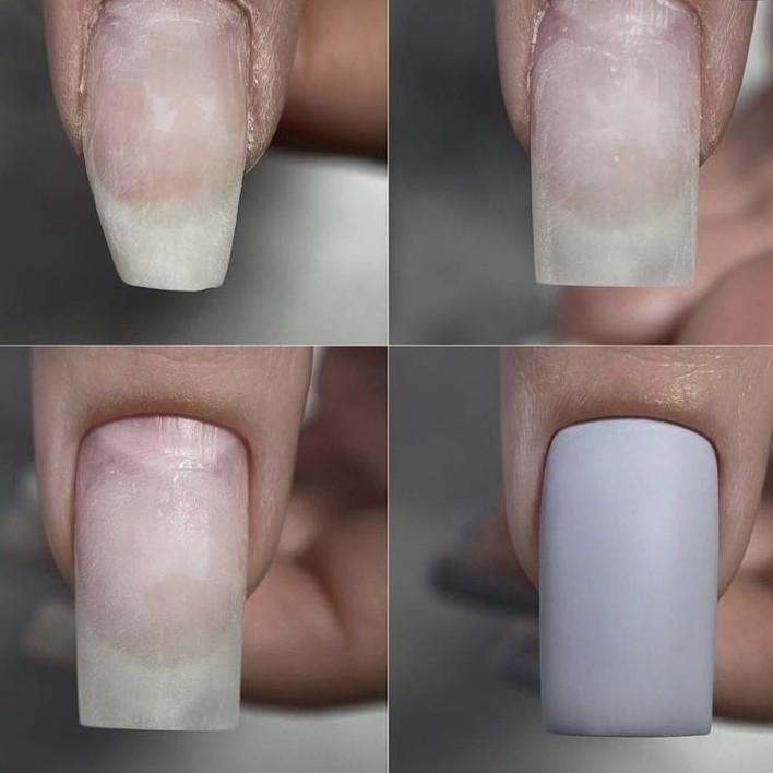 Ремонт одного ногтя (доращивание уголков, свободного края)