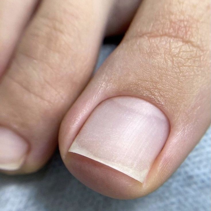 ПЕДИКЮР БЕЗ ПОКРЫТИЯ