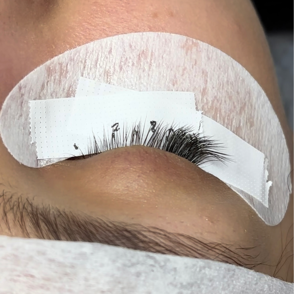 Уголки глаз