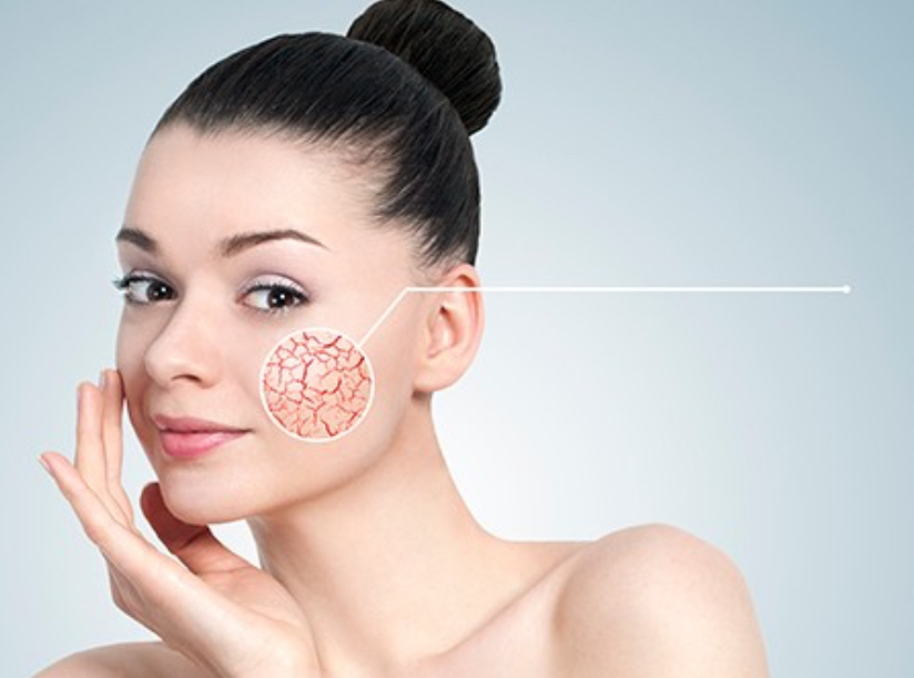 «Антикупероз»