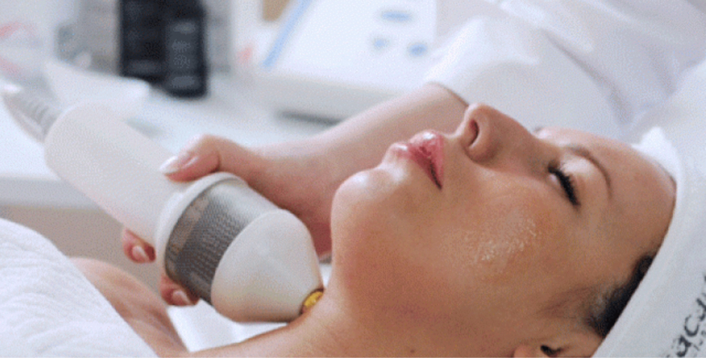 Криотерапия